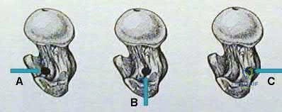 Illustration 289 for OrthoCash: Trauma MCQs & Cases for a yearold woman