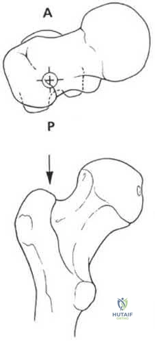 Illustration 290 for OrthoCash: Trauma MCQs & Cases for a yearold woman