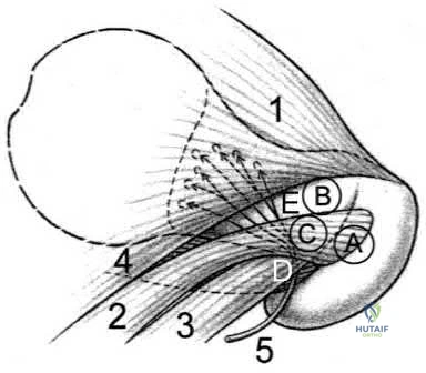 Illustration 292 for OrthoCash: Trauma MCQs & Cases for a yearold woman