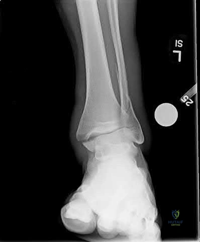 Illustration 293 for OrthoCash: Trauma MCQs & Cases for a yearold woman