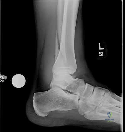 Illustration 294 for OrthoCash: Trauma MCQs & Cases for a yearold woman