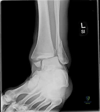 Illustration 295 for OrthoCash: Trauma MCQs & Cases for a yearold woman
