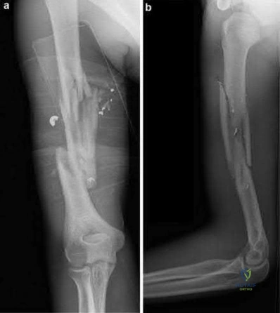 Illustration 300 for OrthoCash: Trauma MCQs & Cases for a yearold woman