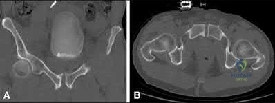Illustration 302 for OrthoCash: Trauma MCQs & Cases for a yearold woman