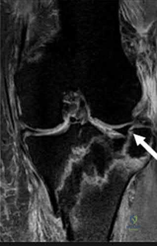 Illustration 305 for OrthoCash: Trauma MCQs & Cases for a yearold woman