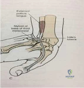 Illustration 310 for OrthoCash: Trauma MCQs & Cases for a yearold woman