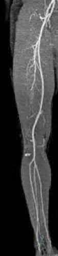 Illustration 313 for OrthoCash: Trauma MCQs & Cases for a yearold woman