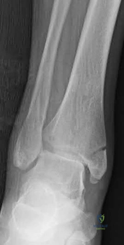 Illustration 317 for OrthoCash: Trauma MCQs & Cases for a yearold woman