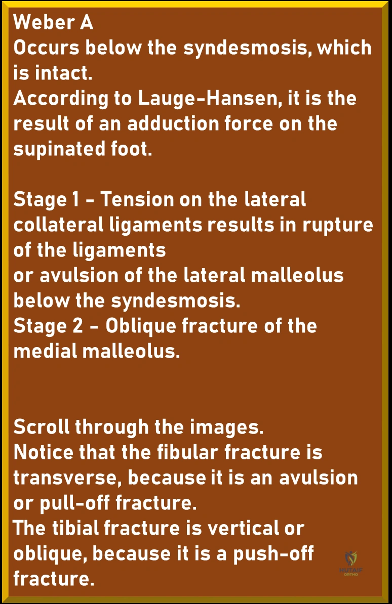 Illustration 4 for Ankle Injuries Weber A