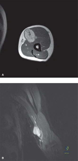 Clinical Image