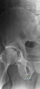 Shoulder and elbow structured oral examination question1