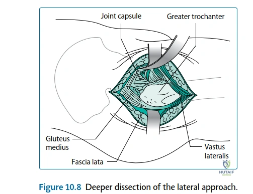 Clinical Image