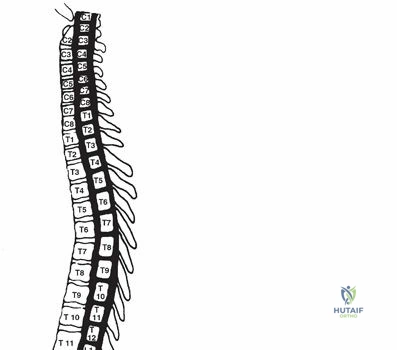 Illustration of thoracolumbar spine injuries - Dr. Mohammed Hutaif
