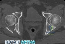 Illustration of trial trial trial - Dr. Mohammed Hutaif