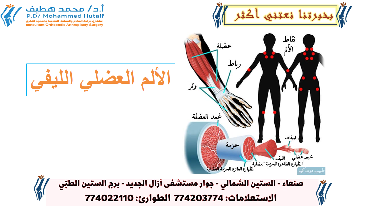 الأدوية لتخفيف أعراض الألم العضلي الليفي