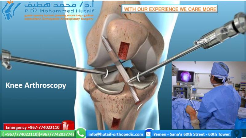 Knee Arthroscopic Procedures: Your Path to Pain Relief & Recovery