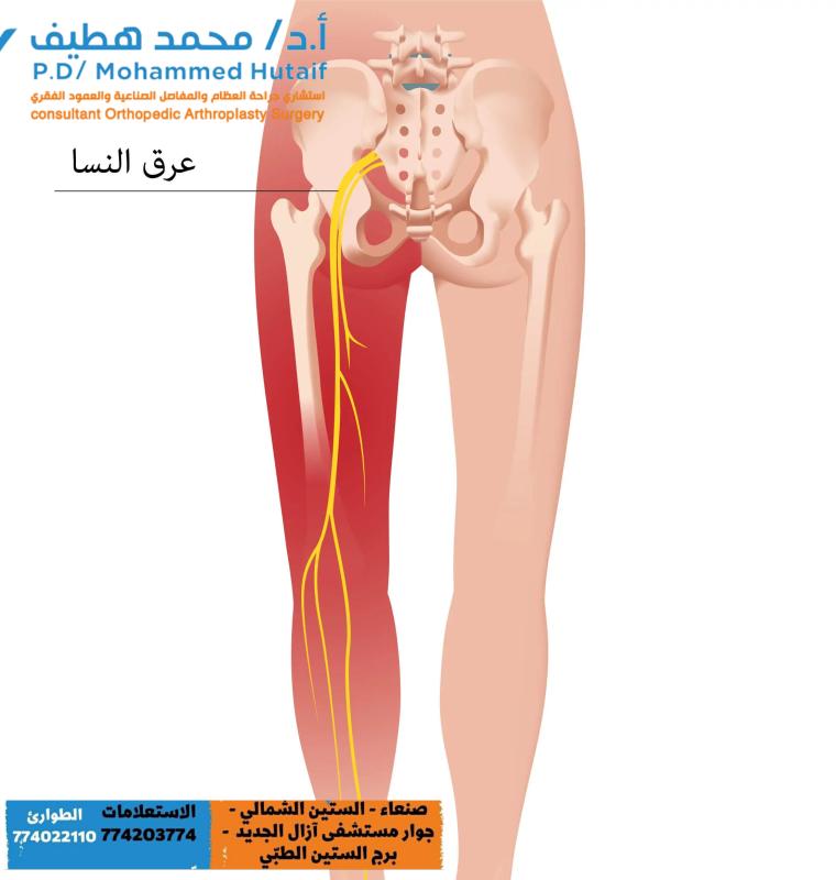 إليك بعض الخيارات المقترحة، مع مراعاة المتطلبات الإبداعية والتقنية:

* **وداعًا لألم عرق النسا: دليلك الشامل للتعافي** (42 حرف)
* **اكتشف حلول عرق النسا: تخفيف فوري ونتائج طويلة الأمد** (49 حرف)
* **تخلص من عرق النسا: أسرار العلاج والوقاية الفعالة** (43 حرف)
* **تعرف على عرق النسا: الأسباب، الأعراض، وأحدث العلاجات** (44 حرف)
* **دليلك للتغلب على عرق النسا: نصائح ذهبية وخطوات عملية** (46 حرف)
* **سيطر على عرق النسا: استراتيجيات فعالة لتخفيف الألم** (42 حرف)
* **عرق النسا: كيف تتخلص من الألم وتستعيد حياتك الطبيعية؟** (47 حرف)
* **عرق النسا: معلومات أساسية ونصائح عملية لتخفيف الألم** (45 حرف)

أعتقد أن العنوان **"وداعًا لألم عرق الن