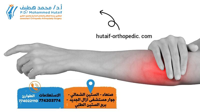 ما هو مرفق التنس (التهاب اللقيمة الجانبي)؟