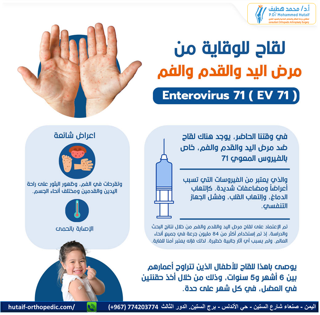 لقاح مرض اليد والقدم والفم