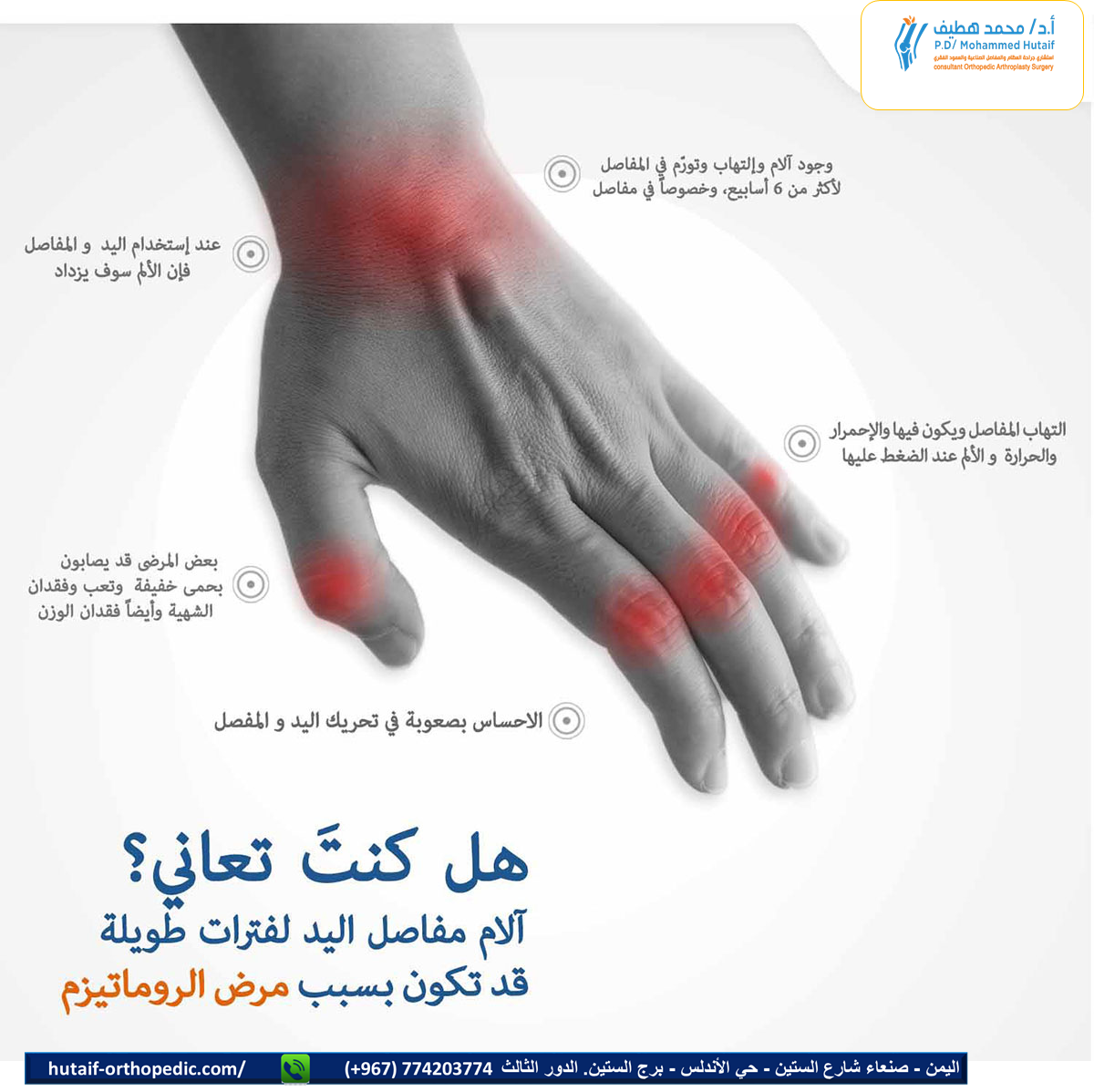 آلام  مفاصل اليد 