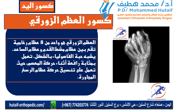 كسور العظم الزورقي