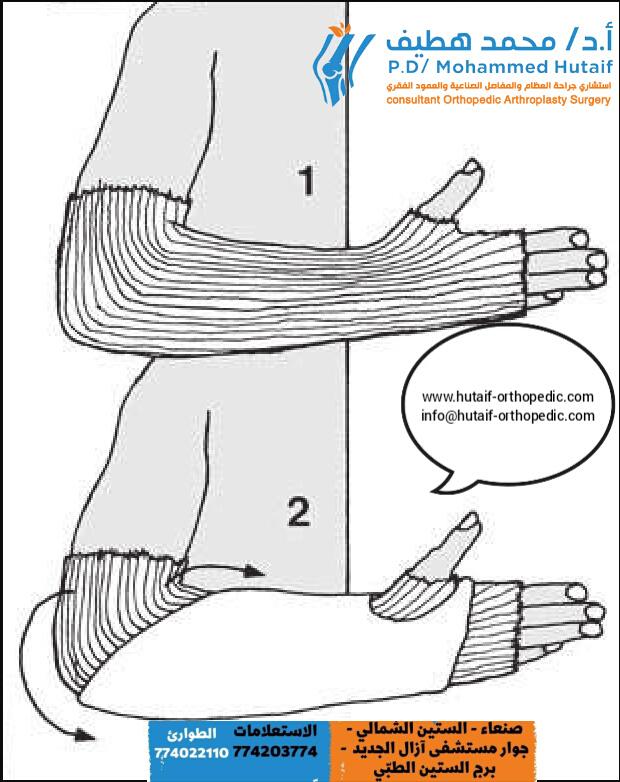 سلسة منشورات تقنيات الإرجاع المغلق والجبس العلاج التحفظي للكسور