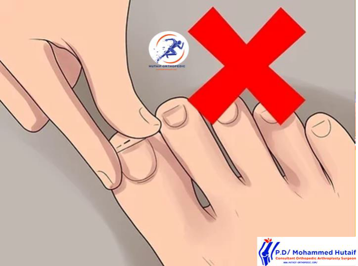 تنزيل كتيب كيفية إزالة الشوك من اليد او القدم