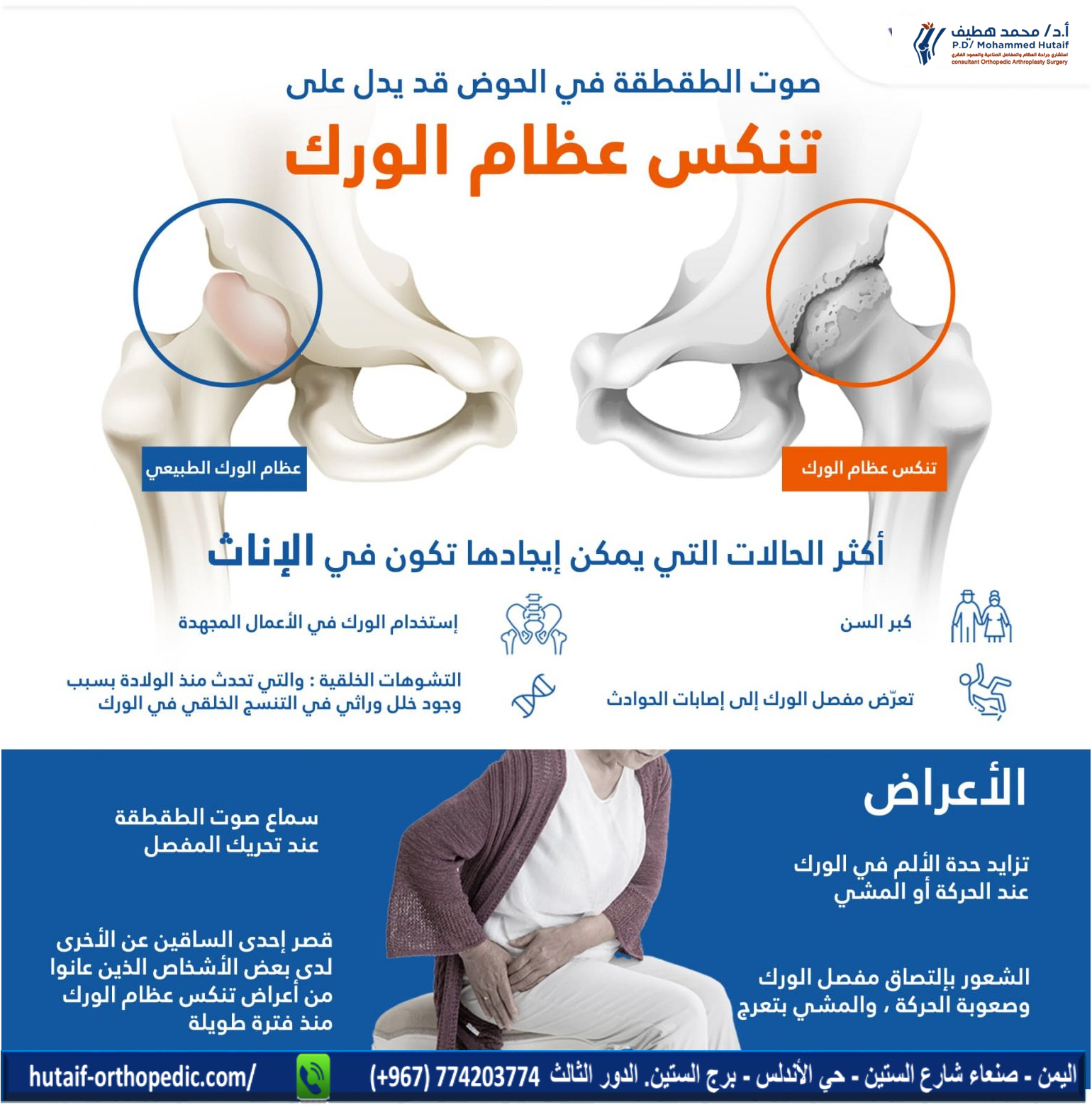  الطقطقة في الحوض قد تشير إلى تدهور(تنكس ) في عظام الورك