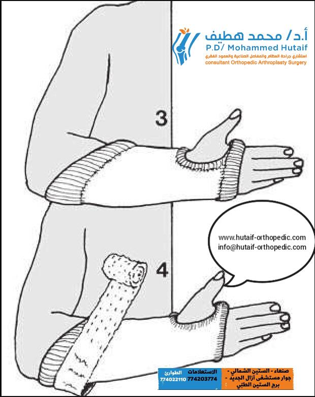 سلسة منشورات تقنيات الإرجاع المغلق والجبس العلاج التحفظي للكسور المنشور (8) تقنيات الجبس الأساسية - حماية الجلد المنشور