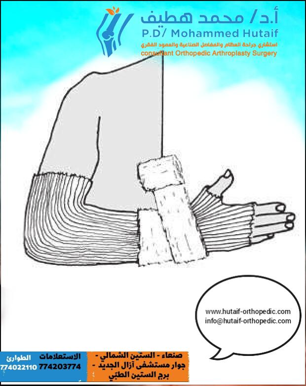 سلسة منشورات تقنيات الإرجاع المغلق والجبس العلاج التحفظي للكسور المنشور (9) تقنيات الجبس الأساسية - حماية الجلد المنشور