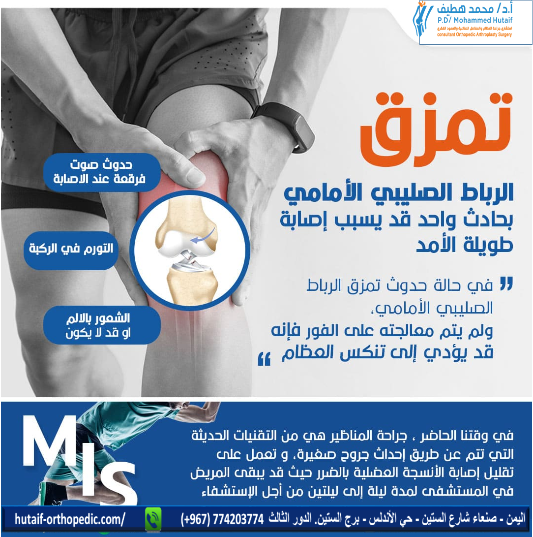 قد يؤدي تمزق الرباط الصليبي الأمامي إلى إصابة طويلة الأمد