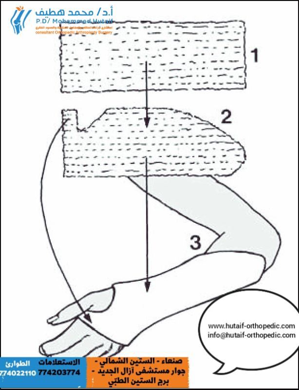 سلسة منشورات تقنيات الإرجاع المغلق والجبس العلاج التحفظي للكسور المنشور (11) تقنيات الجبس الأساسية - حماية الجلد المنشور