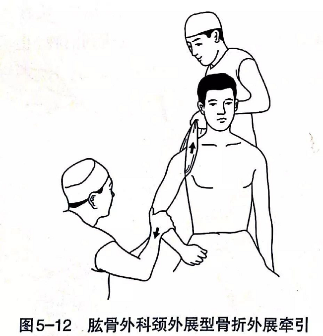 دليلك الأمثل لالتئام الكسور: تقنيات إعادة التأهيل المبتكرة