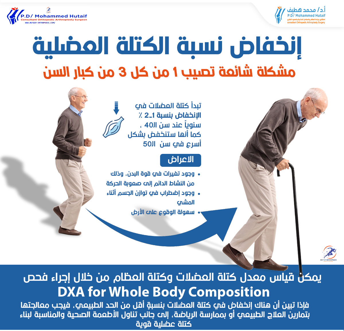 إنخفاض نسبة الكتلة العضلیة، مشكلة شائعة تصیب 1 من كل 3 من كبار السن