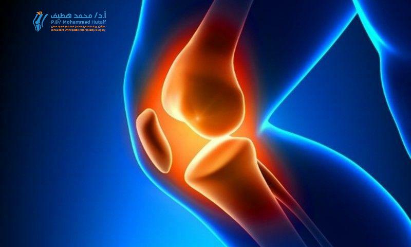 الركبة المؤلمة: أسبابها وطرق الوقاية منها