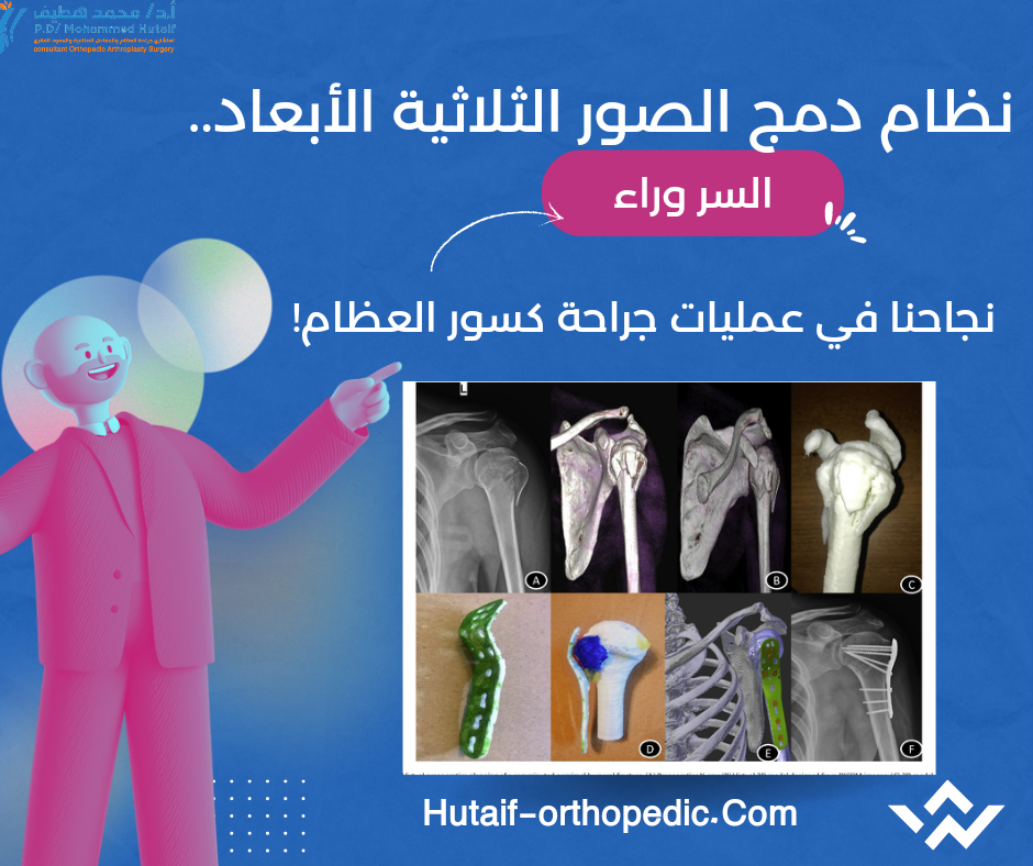 نظام دمج الصور الثلاثية الأبعاد.. السر وراء نجاحنا في عمليات جراحة كسور العظام!