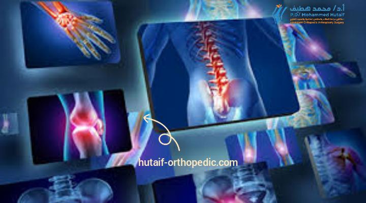 الأبحاث الحديثة تكشف عن علاجات ووسائل وقاية جديدة لكسور العظام والمفاصل"