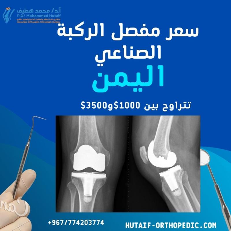 "مفصل الركبة الصناعي في اليمن صنعاء: هل يتناسب سعره مع قدرات المرضى؟"