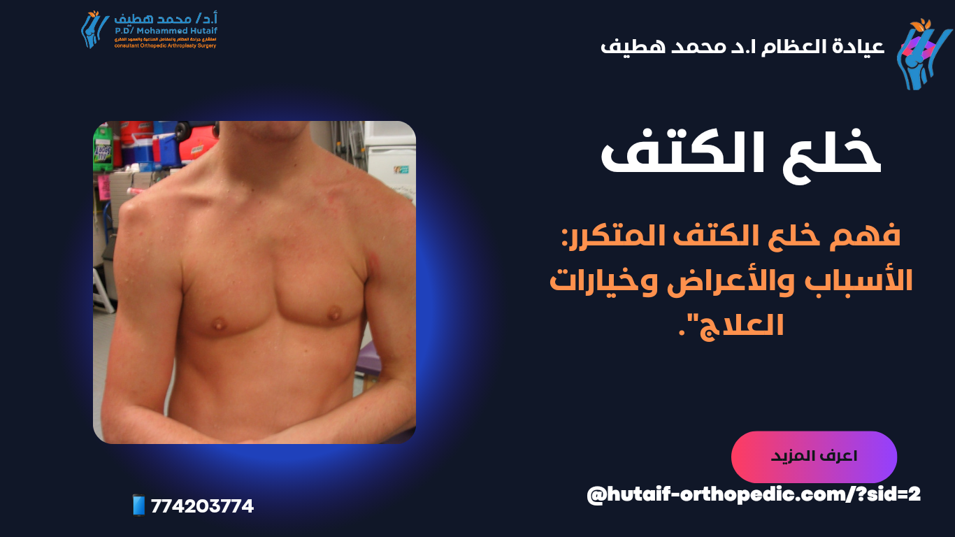 خلع الكتف المتكرر: الأسباب والأعراض والعلاج