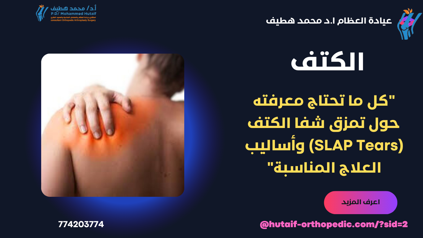 "كل ما تحتاج معرفته حول تمزق شفا الكتف (SLAP Tears) وأساليب العلاج المناسبة"
