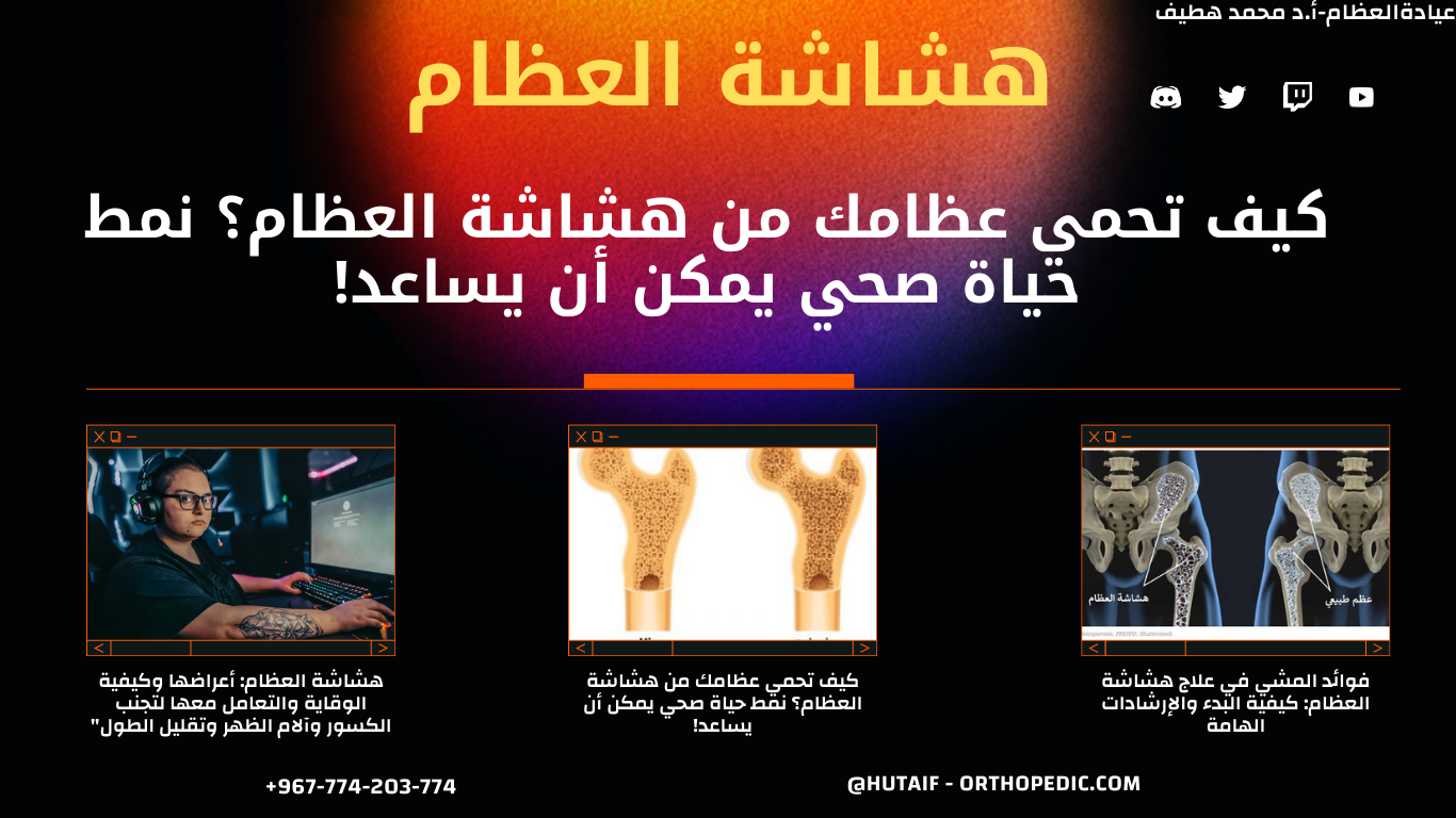 كيف تحمي عظامك من هشاشة العظام؟ نمط حياة صحي يمكن أن يساعد!