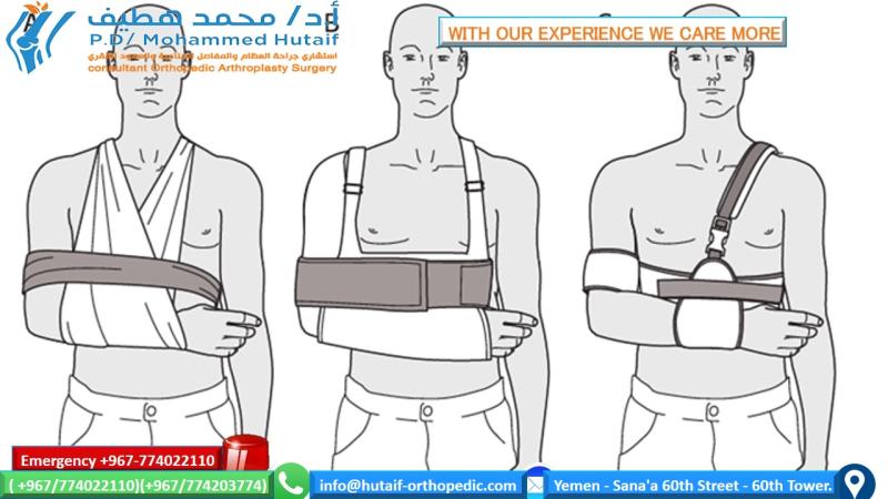 Mastering Nonoperative Care for Proximal Humeral Fractures Greater