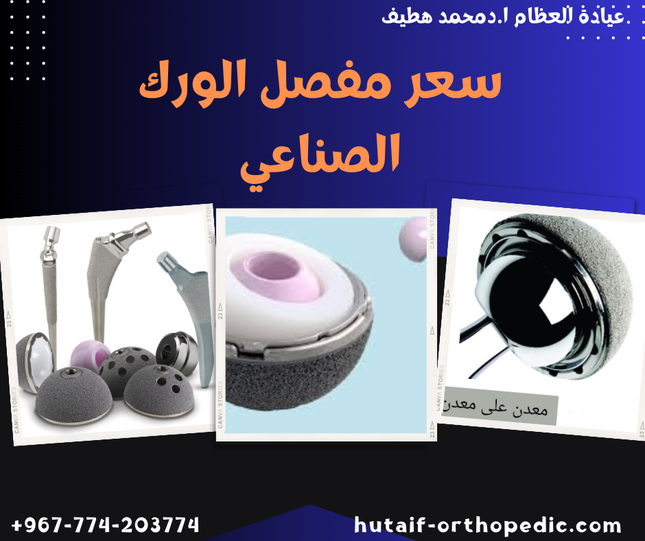 كل ما تحتاج معرفته عن سعر مفصل الورك الصناعي