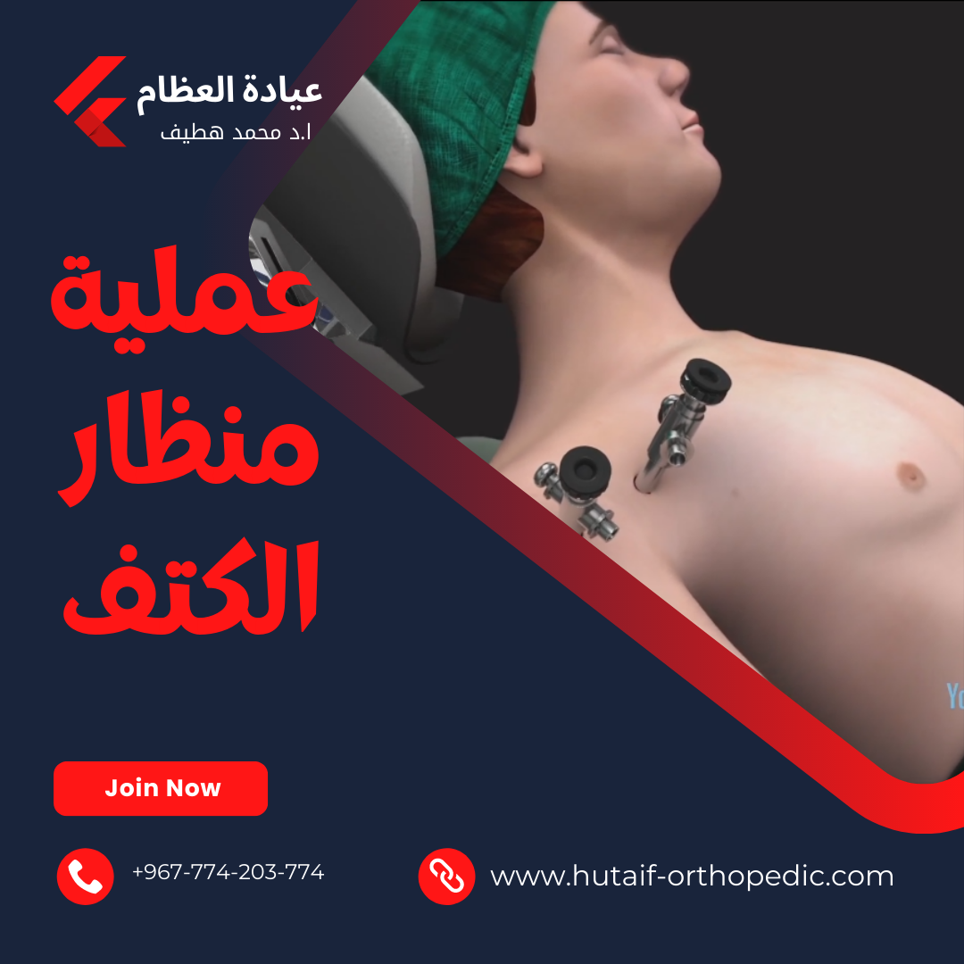  عملية خلع الكتف بالمنظار: ما هي وكيف تجرى؟