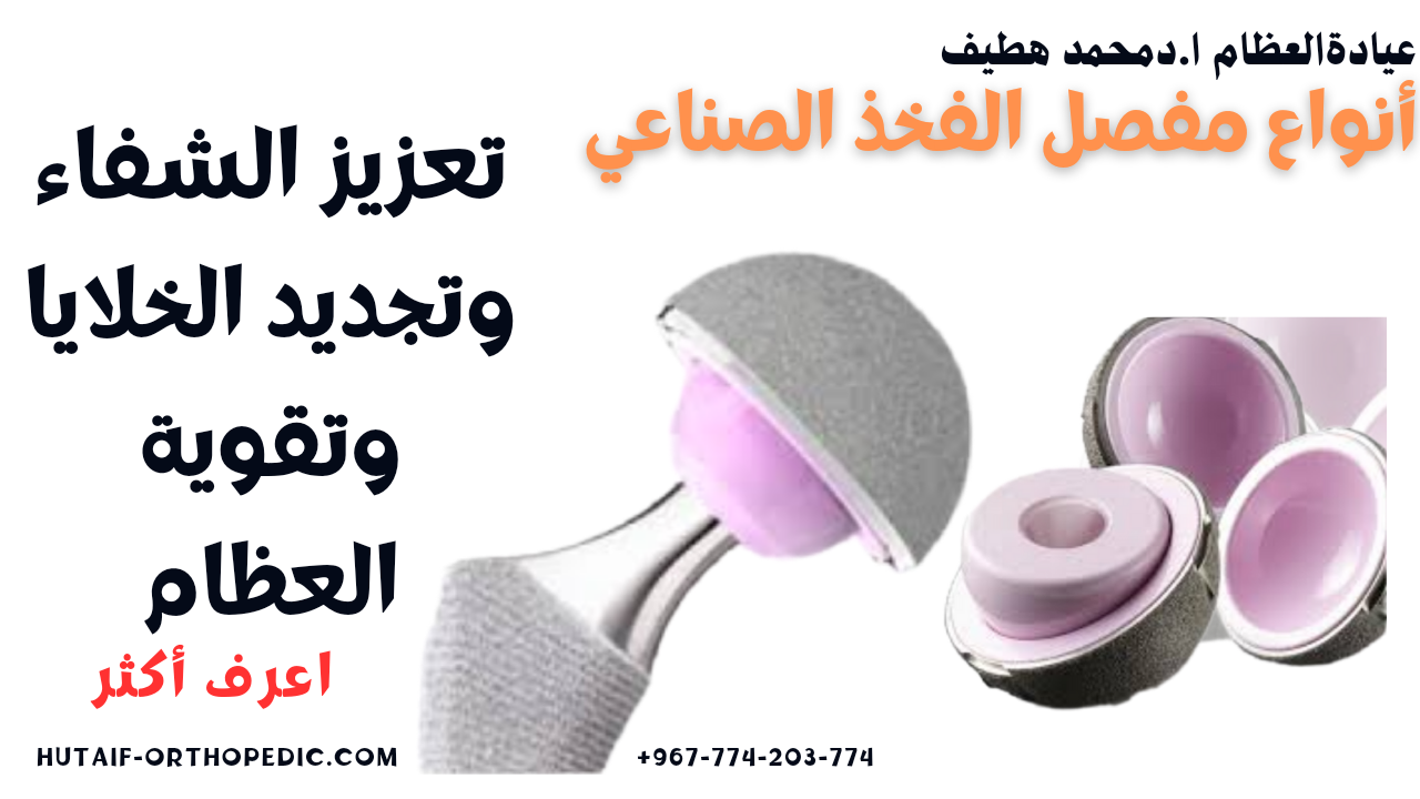 أنواع وأسعار مفصل الفخذ: كل ما تحتاج معرفته