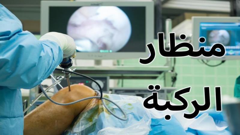 منظار الركبة: ما هو؟ وما هي فوائده؟