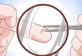 نصائح لإزالة الشوك من اليد أو القدم