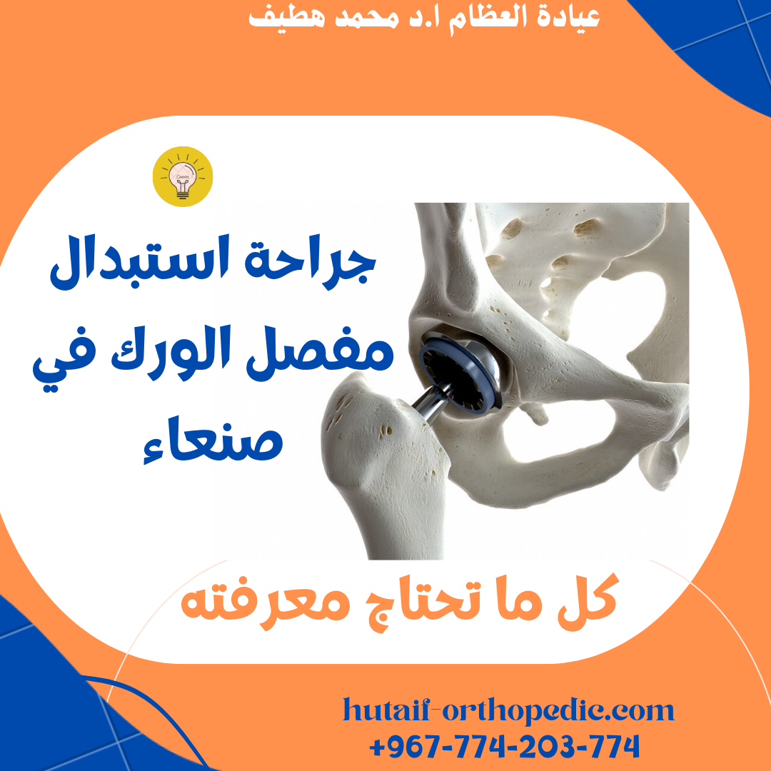 كل ما تحتاج معرفته عن عملية استبدال مفصل الورك