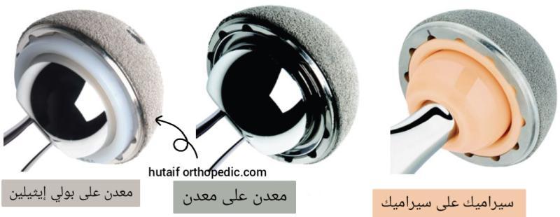 شهادات استبدال مفصل الورك وشهادات المرضى في مركز هطيف للعظام والمفاصل