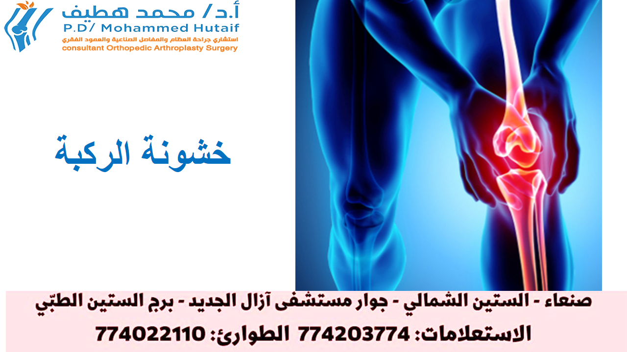 خشونة الركبة: أفضل العلاجات وكيفية التخفيف من الأعراض